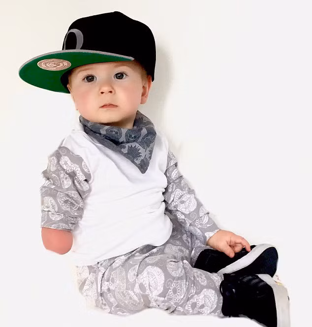 Oakley với hội chứng dị tật bẩm sinh, khi sinh ra đã không có bàn tay phải. Tuy nhiên, sự tự tin và lạc quan cùng với phong thái cá tính của cậu bé đã thu hút sự chú ý của cộng đồng mạng xã hội.