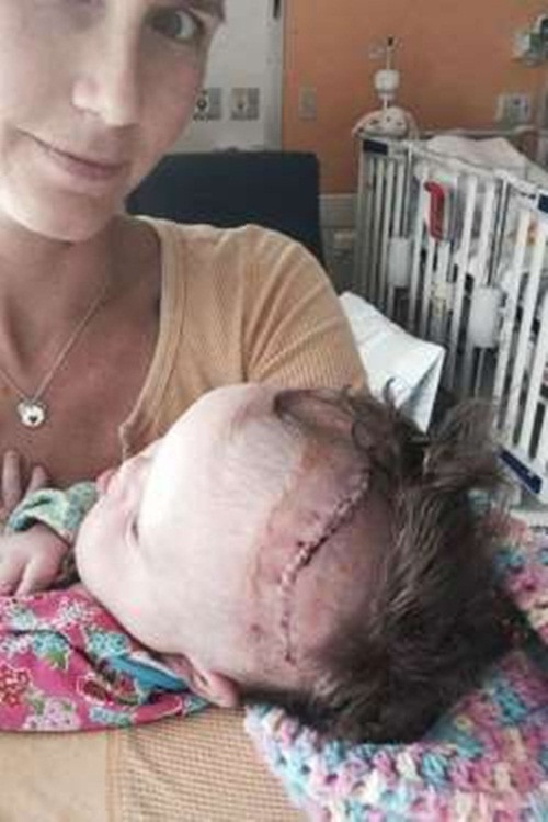 Erkika Jones. Khi mang thai, mẹ bé đã được thông báo thai nhi bị hội chứng down và khi bé sinh ra lại bị khối u não có thể gây tử vong. Bác sỹ thậm chí đã khuyên gia đình chuẩn bị để tiễn con lên thiên đường. Rất may là một tiến sỹ y khoa đã phẫu thuật cho em để loại bỏ khối u hoàn toàn. Ba ngày sau, bé được đoàn tụ với gia đình.