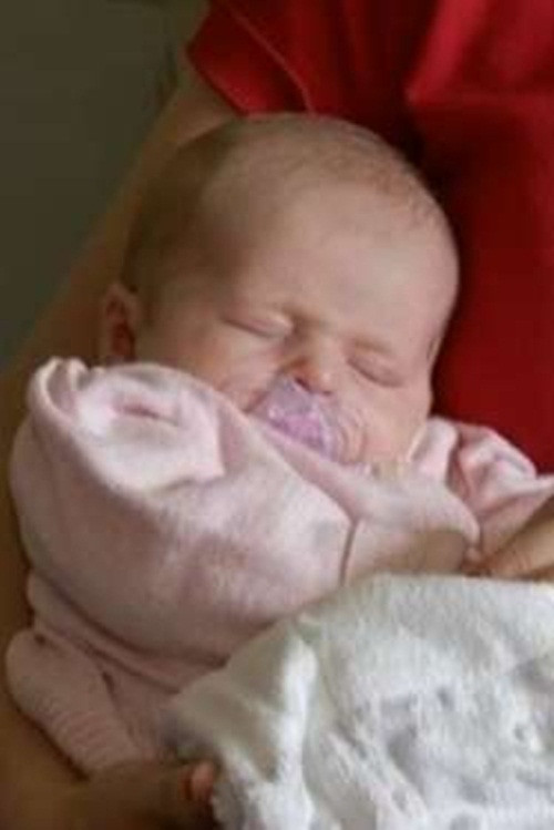 Bé Milo. Bà mẹ trẻ Glenda Budworth, người đang phục hồi từ bệnh ung thư biết rằng rất khó để có con. Thật bất ngờ năm sau Glenda được tin mình có thai.