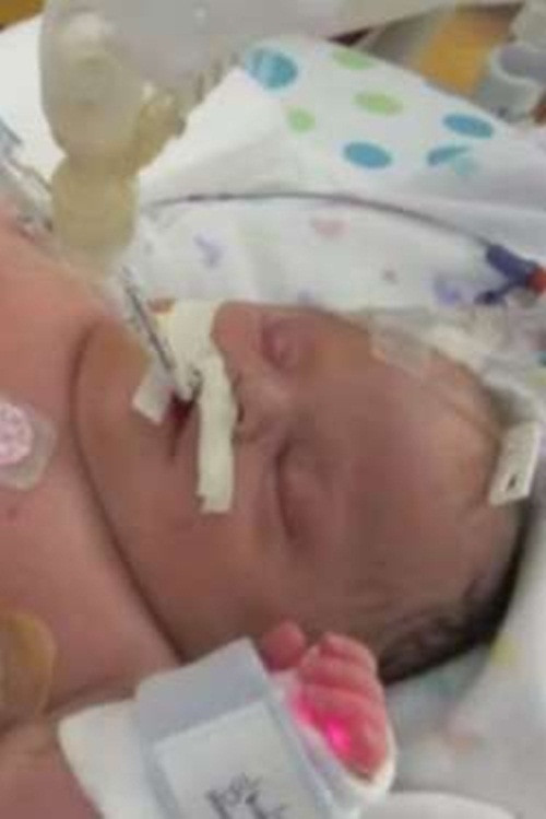 Khi được nghe tin con mình bị hội chứng đao và có thể nó sẽ bị chết lưu trong bụng. Cô Karen và chồng vẫn quyết định giữ lại con. Họ luôn hát bài “light of mine” khi cô mang thai. Sauk hi sinh ra, các bác sỹ chắc chắn rằng bé chỉ sống được vài ngày.