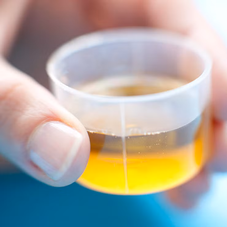 Dùng sai liều hay dùng quá nhiều. Người dùng thuốc thường vô tình dùng quá số lượng quy định, đặc biệt khi nói đến thuốc giảm đau acetaminophen dạng lỏng dành cho trẻ em.