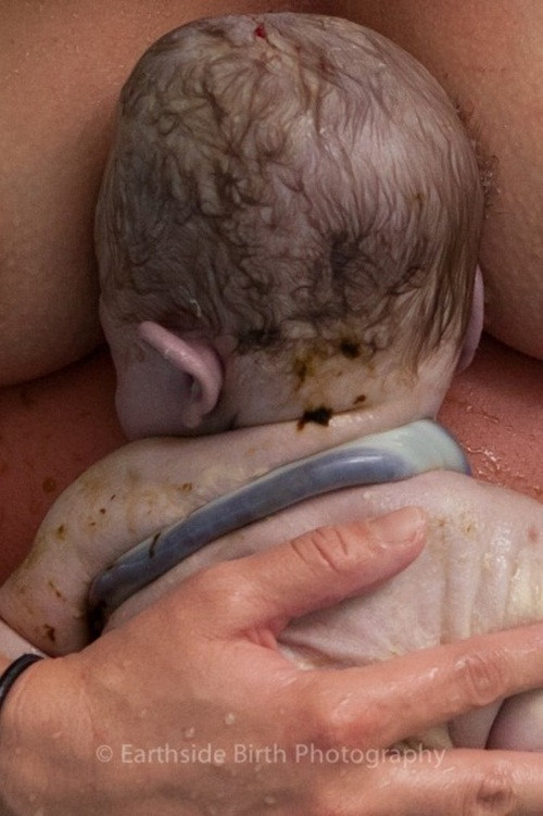 Nhiếp ảnh gia nắm bắt khoảnh khắc người mẹ tháo dây rốn ra khỏi con trai sau khi đón chào con trai bằng phương pháp sinh nước.