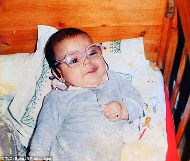 Lahdohi phải chịu đựng 18 năm chung sống với tình trạng này, anh đã phải khó chịu vì luôn bị mọi người nhìn chằm chằm mỗi khi ra đường.