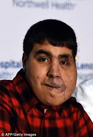 “Tôi cảm ơn tất cả những người đã tạo cơ hội cho tôi được thực hiện cuộc phẫu thuật này, nó sẽ thay đổi cuộc sống của tôi. Tôi và gia đình đều cảm thấy rất hạnh phúc và biết ơn đội ngũ điều trị.”