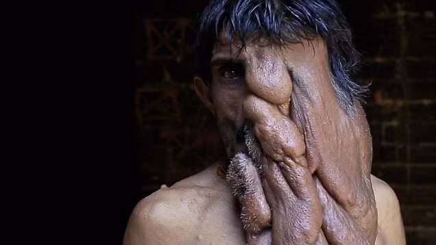 Thế nhưng, Kanai vẫn hy vọng vào một phép lạ sẽ được phẫu thuật trong tương lai gần để có được cuộc sống của người bình thường.