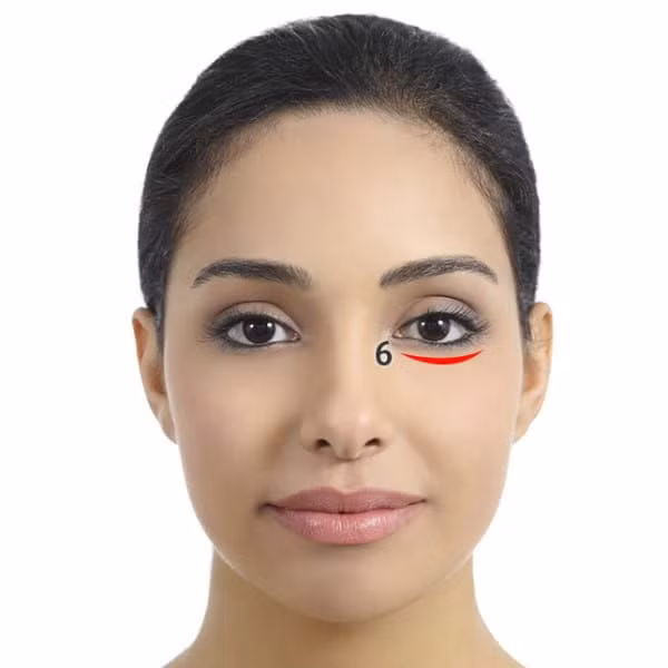 Bọng mắt. Sáng sớm ngủ dậy có thể sẽ xuất hiện bọng mắt do bạn thiếu ngủ nhưng nó cũng có thể liên quan đến thận yếu. Nó cũng có thể liên quan đến việc lưu thông máu kém. Bạn hãy cố gắng tập những bài yoga hoặc massage nhẹ.