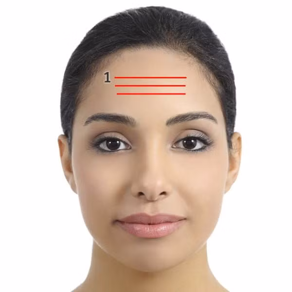 Nếp nhăn ngang trán. Các đường nhăn trên trán thường được gọi là “đường lo lắng” lý do chắc chắn bạn đang bị stress. Chúng là dấu hiệu cho thấy bạn cần nghỉ ngơi và thư giãn. Những nếp nhăn ngang trán cũng kết nối trực tiếp với dạ dày. Chúng có thể là dấu hiệu bạn đang ăn quá nhiều đường và chất béo hoặc uống không đủ nước.