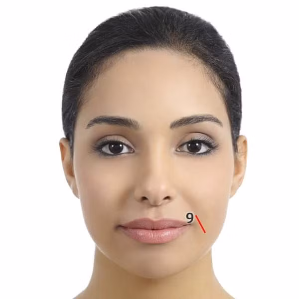 Nếp nhăn khóe miệng. Nếp nhăn kiểu này liên quan đến ruột kết. May mắn thay, các vấn đề về ruột kết có thể cải thiện dễ dàng với chế độ ăn uống gồm chất xơ, vitamin D, những bài tập thể dục và uống nhiều nước.