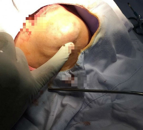 Nhung vu hoai tu khung khiep do tham my hong o VN-Hinh-3