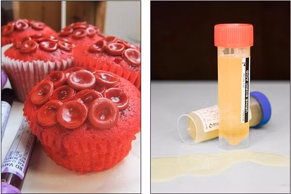 Những chiếc bánh cupcake mô phỏng tế bào máu.