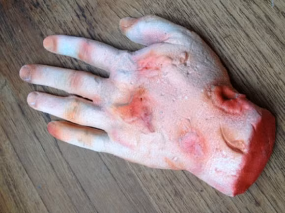 Chiếc bánh kem kinh dị mô phỏng bệnh lây truyền trên tay người.