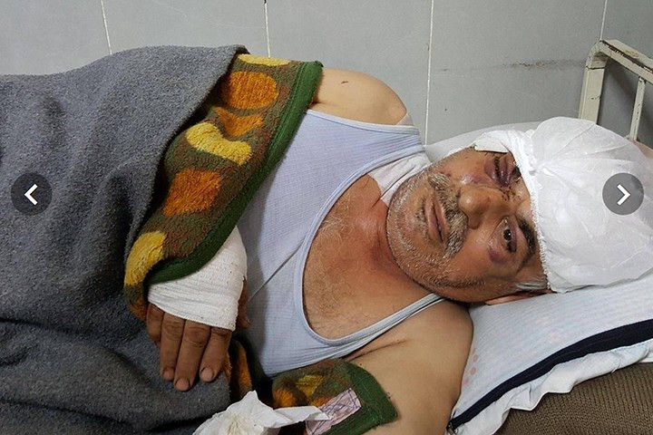 Ông Mohamed Hussein, một nông dân 58 tuổi, nằm trong bệnh viện Afrin. Ông bị thương ở đầu và mắt do bom thả từ máy bay. Ảnh: Yara Ismail.