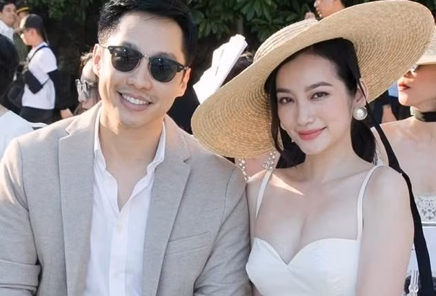 Truong Tri Truc Diem mat loi, mat sung vi bi benh cuong giap