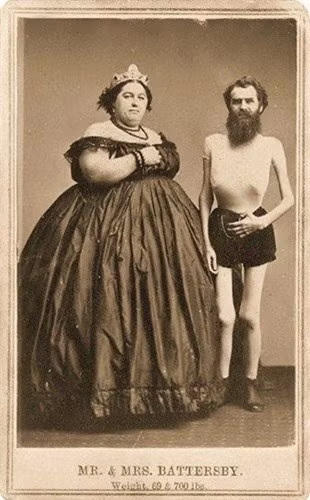 Bộ xương sống John Battersby và người vợ béo phì của ông, bà Hannah Battersby.