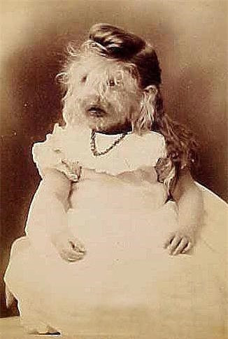 Alice Doherty, đến từ Minneapolis và bị bệnh hypertrichosis lanuginosa khiến lông mọc dài khắp mặt và cơ thể.