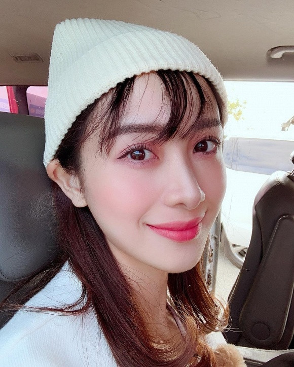 Bi 'to' phau thuat tham my toan bo guong mat, Jun Vu buc xuc 