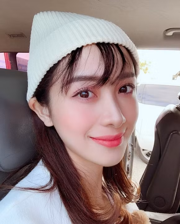 Bi 'to' phau thuat tham my toan bo guong mat, Jun Vu buc xuc 