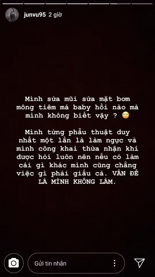 Bi 'to' phau thuat tham my toan bo guong mat, Jun Vu buc xuc 