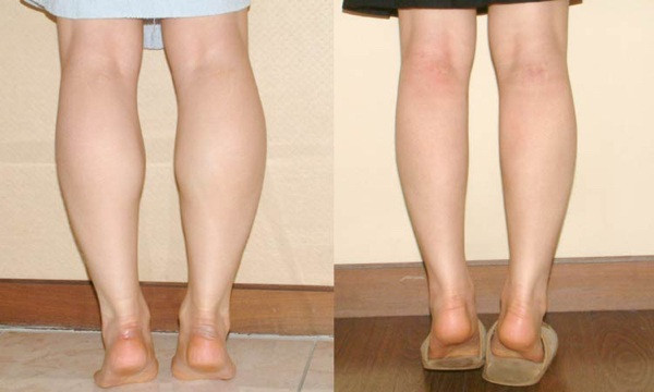  Chân to: Là phụ nữ chẳng ai thích mình có một tướng chân to, ai cũng mong mình có một đôi chân dài thon thả. Nhưng bạn cũng đừng buồn nếu mình sở hữu một cặp chân to bởi phụ nữ chân to thường là người phụ nữ may mắn.