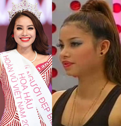 Pham Huong bat ngo bi to nhieu lan phau thuat tham my-Hinh-5