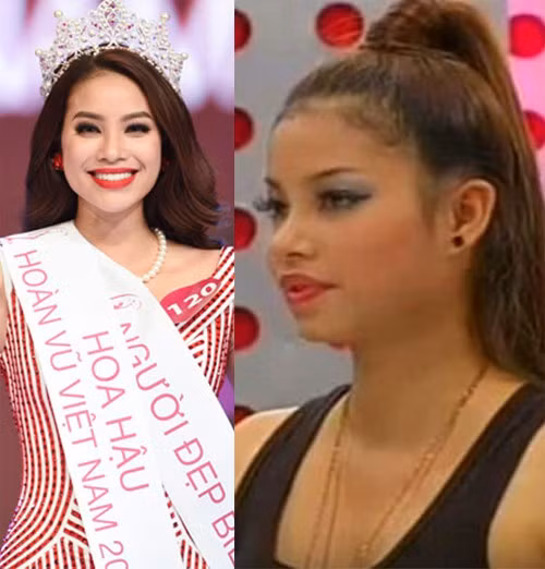 Pham Huong bat ngo bi to nhieu lan phau thuat tham my-Hinh-5