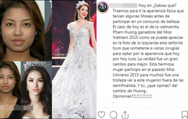 Pham Huong bat ngo bi to nhieu lan phau thuat tham my