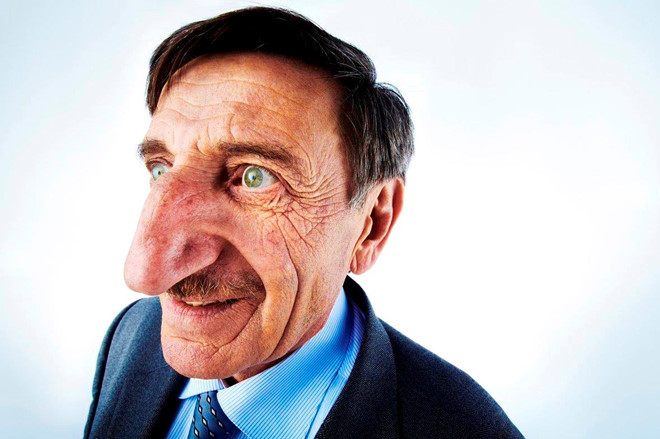 Chiếc mũi dài nhất: Ông Mehmet Ozyurek, ở Thổ Nhĩ Kỳ, sở hữu chiếc mũi dài nhất thế giới với kích thước 8,8 cm (tính riêng phần sống mũi). Kỷ lục được ghi nhận vào năm 2010. Ảnh: Reddit.