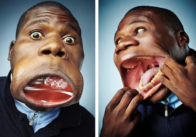 Miệng rộng nhất: Với kích thước bề ngang rộng 17 cm khi kéo căng miệng hết cỡ, Francisco Domingo Joaquim ở Angola đã lập kỷ lục Guinness và chính thức được công nhận là người có miệng rộng nhất trên thế giới vào năm 2011. Miệng của Francisco có khả năng đàn hồi như cao su và có thể nhét vừa một lon nước ngọt nằm ngang. Ảnh: Blogspot.