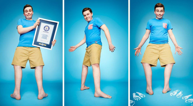 Đôi chân có vòng quay lớn nhất: Cậu bé Maxwell Day, đến từ London, Anh, có đôi bàn chân mềm dẻo đến nỗi có thể quay hẳn ra sau với chân phải là một góc 157 độ và chân trái là một góc 143 độ. Maxwell cho biết cậu sở hữu khả năng khác thường này từ bé và nó không hề đau đớn. Cậu bé lập kỷ lục Guiness với đôi chân có vòng quay lớn nhất thế giới vào năm 2015. Ảnh: Guinessworldrecords.