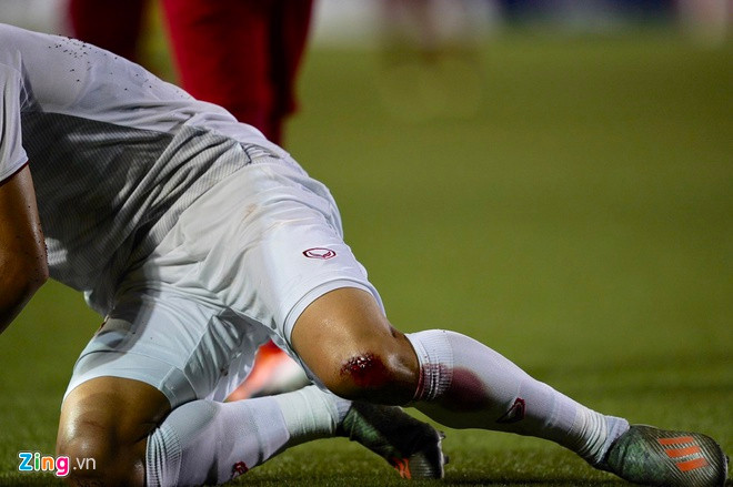 Với thể lực sung mãn và những pha cài bóng tinh quái, Văn Hậu không ít lần khiến các tiền đạo Indonesia chán nản trong phần lấn thời gian thi đấu trận chung kết.