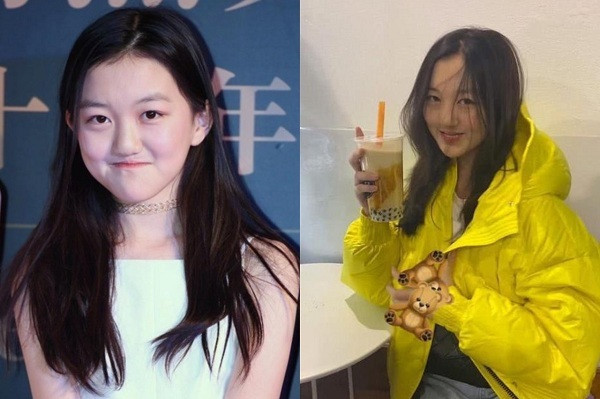 Những hình ảnh gần đây Lý Yên chia sẻ được cư dân mạng chú ý vì cô bé đã biết trang điểm theo xu hướng và tự tin tạo dáng chụp ảnh. Có thể nhận thấy miệng của cô bé theo thời gian đã khá hơn rất nhiều. Đó là thành quả của Lý Á Bằng và Vương Phi đã không ngừng cố gắng đưa con đi phẫu thuật khắp nơi. Cô bé được khen ngợi vì cá tính.