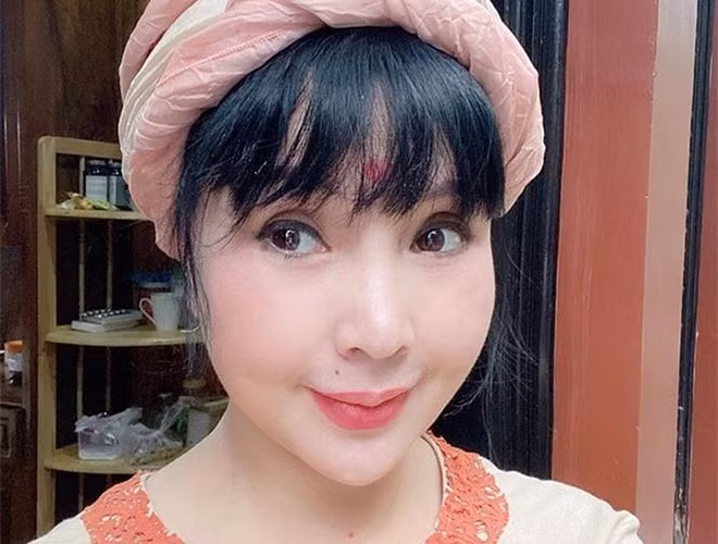 NSND Lan Hương từng lên tiếng thừa nhận làm lại xương gò má, đồng thời khẳng định các nét khác trên mặt vẫn giữ nguyên. Tuy nhiên, nhiều người hâm mộ tỏ ra tiếc nuối nhan sắc trong veo của "Em bé Hà Nội" một thời.