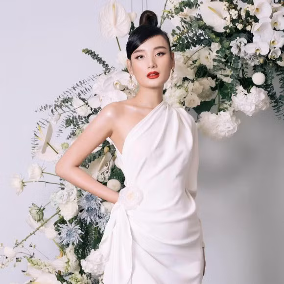 Le Thuy nhap vien cap cuu vi nhiem trung va viem ong dan than-Hinh-2