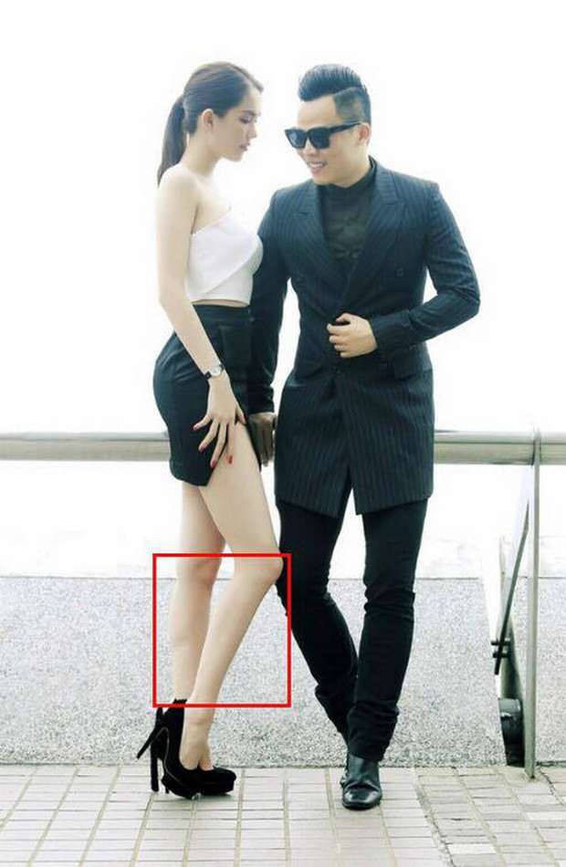 Đôi chân bị cho là không cân xứng sau khi chỉnh sửa của người mẫu Ngọc Trinh. 