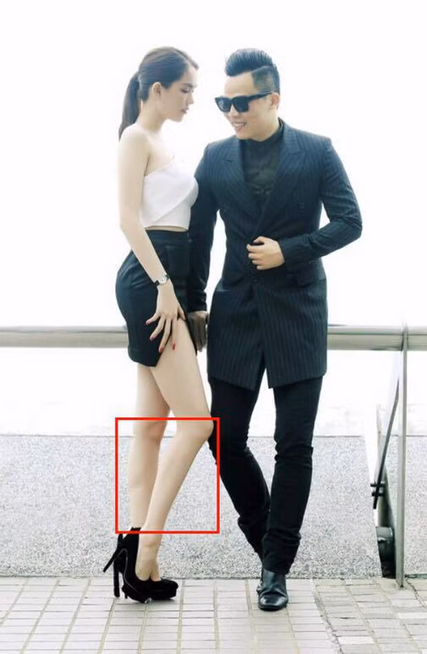 Đôi chân bị cho là không cân xứng sau khi chỉnh sửa của người mẫu Ngọc Trinh. 
