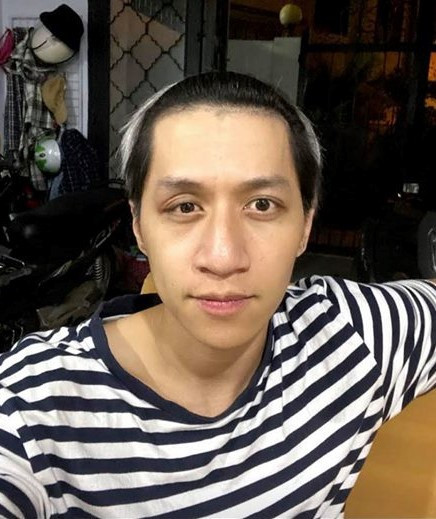 Ca si Bui Duy Ngoc bi tai nan chan thuong nao, liet nua mat-Hinh-2