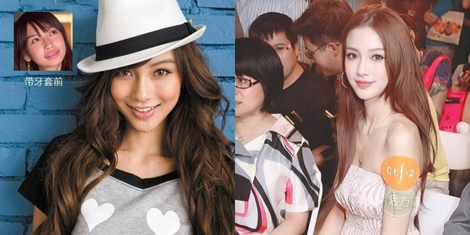 Sau khi chỉnh sửa phần răng, xương hàm của Angelababy nhỏ gọn hơn. Nữ diễn viên lột xác, trở nên gợi cảm, quyến rũ. Người đẹp có cha là người Đức, mẹ là người Trung Quốc vì vậy nhan sắc mang nét phương Tây khá đặc biệt.