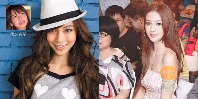 Sau khi chỉnh sửa phần răng, xương hàm của Angelababy nhỏ gọn hơn. Nữ diễn viên lột xác, trở nên gợi cảm, quyến rũ. Người đẹp có cha là người Đức, mẹ là người Trung Quốc vì vậy nhan sắc mang nét phương Tây khá đặc biệt.