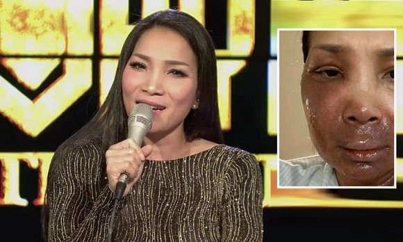 Hong Ngoc khoe anh moi, hoi phuc dieu ky sau vu bong