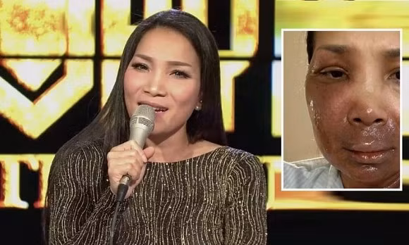 Hong Ngoc khoe anh moi, hoi phuc dieu ky sau vu bong