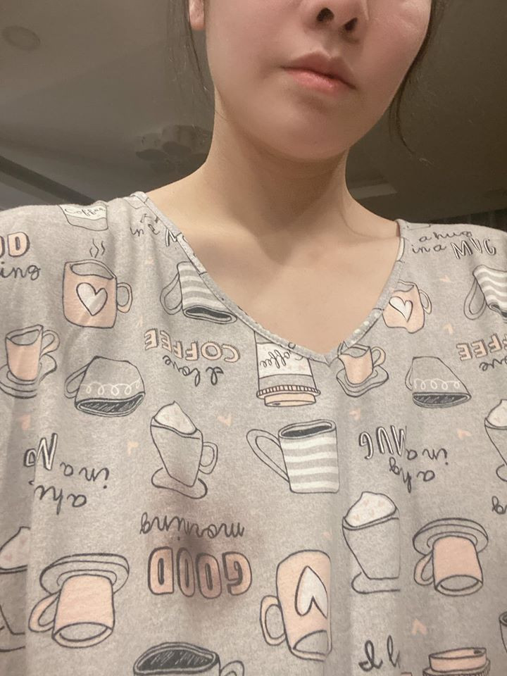 Nhat Kim Anh gap han cuoi nam, suyt mat mot ben nguc vi no may say toc-Hinh-2