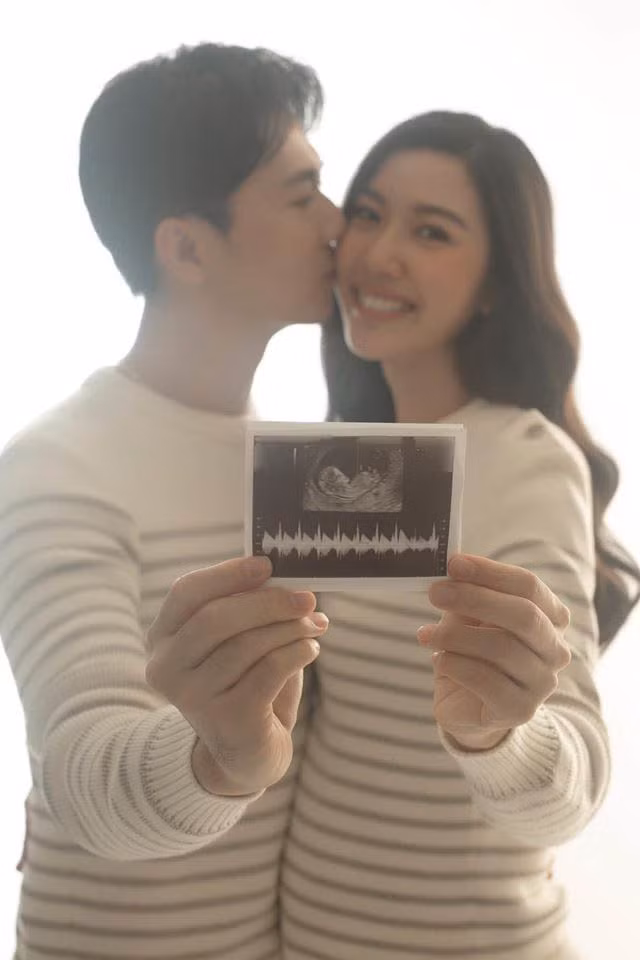 Á hậu Thuý Vân hạnh phúc cùng ông xã khoe bức ảnh siêu âm con đầu lòng.