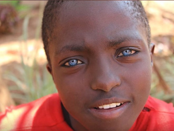 Adrian là đứa trẻ sở hữu đôi mắt ánh sáng xanh. Nhiều người cho rằng đứa trẻ đeo kính áp tròng, song sự thật là đôi mắt tự nhiên mà trời đã ban cho đứa trẻ