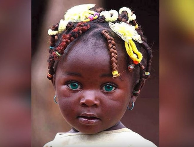 Cô bé sống ở vùng đất chỉ biết tới nghèo đói và chiến tranh, Sudan, lại sở hữu đôi mắt kết hợp hai màu xanh. Đôi mắt của búp bê sống chắc chắn sẽ phá vỡ trái tim của nhiều chàng trai