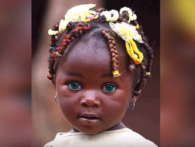 Cô bé sống ở vùng đất chỉ biết tới nghèo đói và chiến tranh, Sudan, lại sở hữu đôi mắt kết hợp hai màu xanh. Đôi mắt của búp bê sống chắc chắn sẽ phá vỡ trái tim của nhiều chàng trai