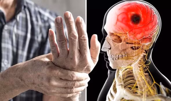 Trieu chung canh bao som con dot quy nang