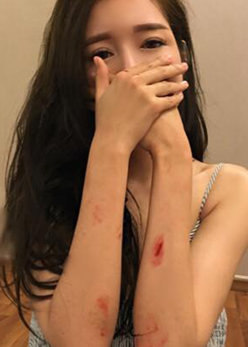 Bà mẹ hai con đã tự thực hiện những cảnh quay hành động nên không tránh khỏi việc cơ thể bị thương tích ở nhiều chỗ.