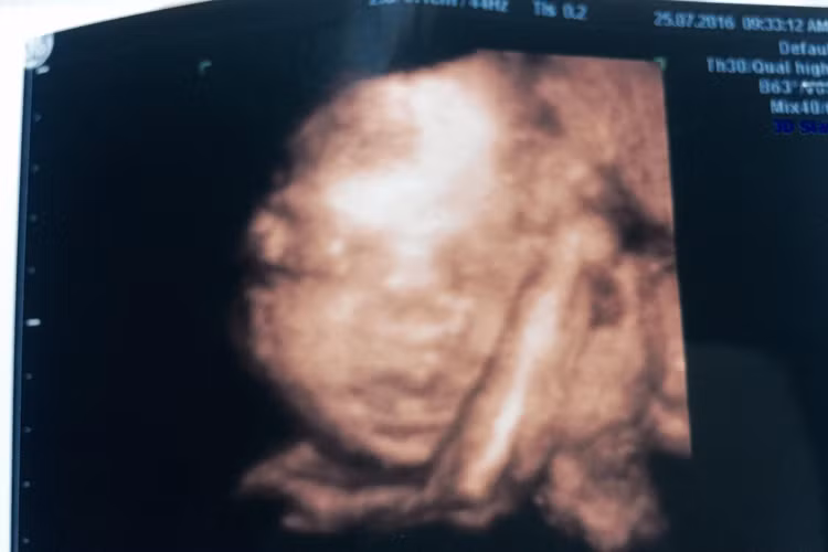 Trước đó, qua những bức ảnh siêu âm thai nhi, Hồng Quế từng cho biết, em bé sở hữu chiếc mũi cao và giống mẹ hơn là bố.