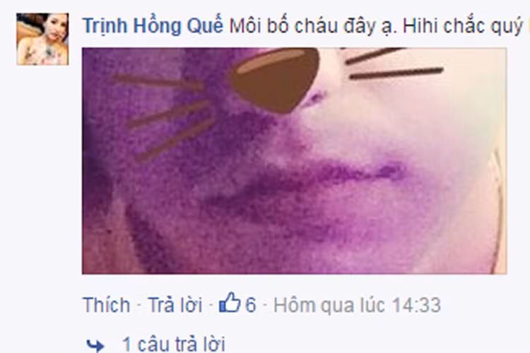 Trước đó, trên trang cá nhân Facebook, Hồng Quế cũng hé lộ một bức ảnh chụp phần môi của bạn trai khi mọi người nhận xét đôi môi của thai nhi giống ca sĩ Khắc Việt.