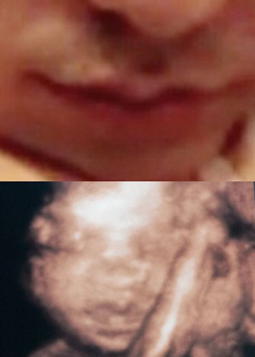 Chân dài 9x khoe em bé trong bụng và bạn trai sở hữu đôi môi giống nhau. Cô hạnh phúc viết: “Giống bố cái miệng dẻo mỏ lắm đây này”.